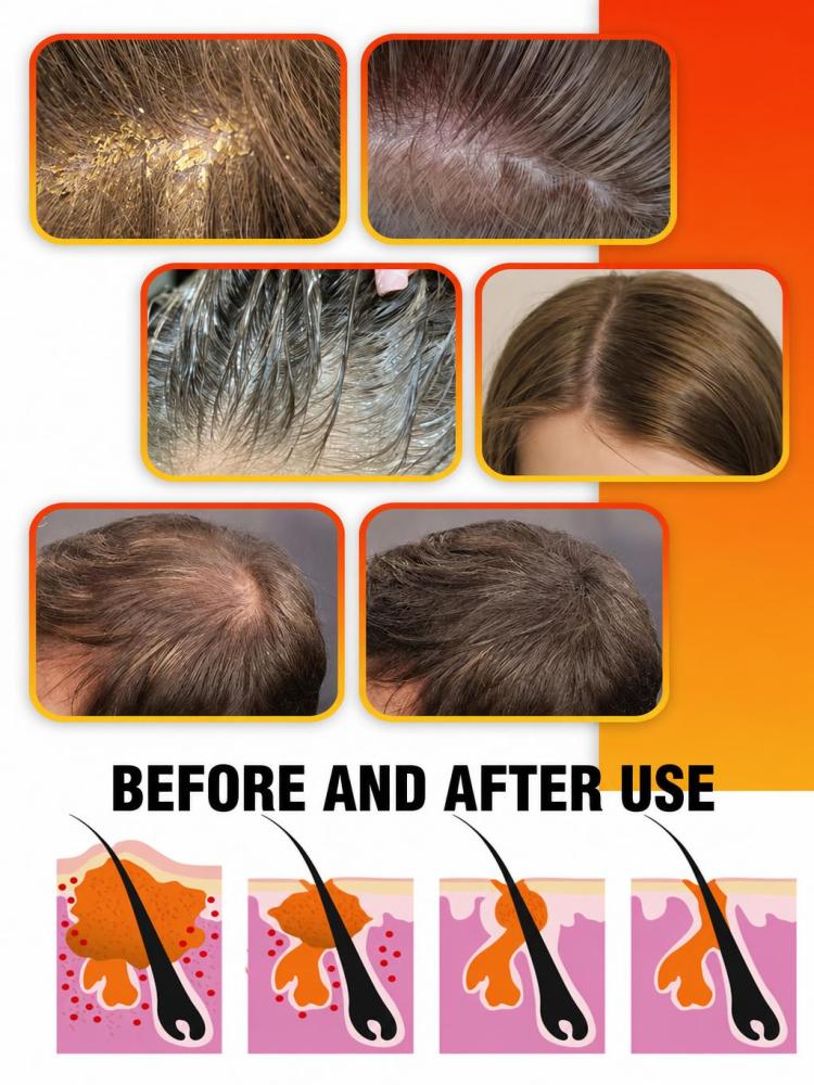 Ежедневный серный шампунь для  – обзор и цена Hair Care Daily Routine